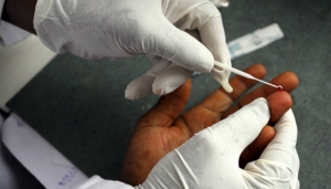 Malaria : des symptômes multiples de la maladie