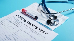 Alerte : Une éventuelle importation du coronavirus pèse sur le Cameroun